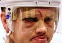 Những chấn thương kinh hoàng trong môn hockey