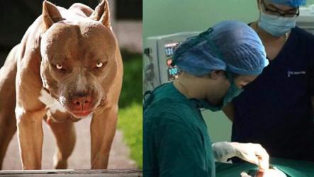 Bé 4 tuổi nguy kịch vì bị chó Pitbull cắn đứt khí quản - giống chó quá nguy hiểm :(
