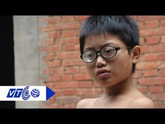 Sự thật về cậu bé 11 tuổi cận 2.000 độ ở Trung Quốc - vãi cả cận ạ ^:)^