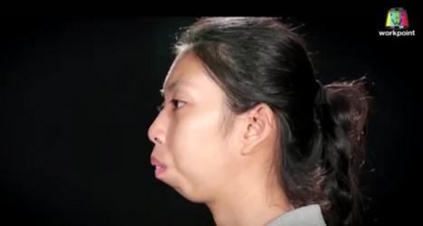 Cô gái Thái Lan nghèo khó đổi đời nhờ phẫu thuật thẩm mỹ