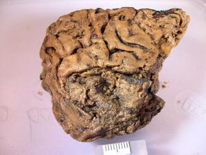 Bí ẩn mảnh não 2.700 năm tuổi, vẫn nguyên vẹn dù cho không hề được tẩm ướp